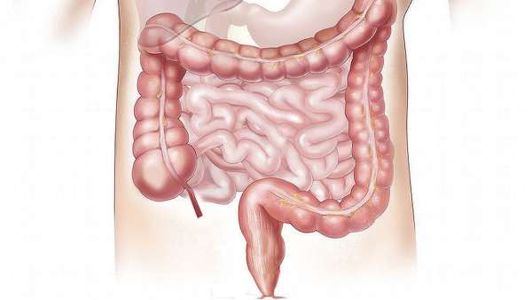 Irritable bowel