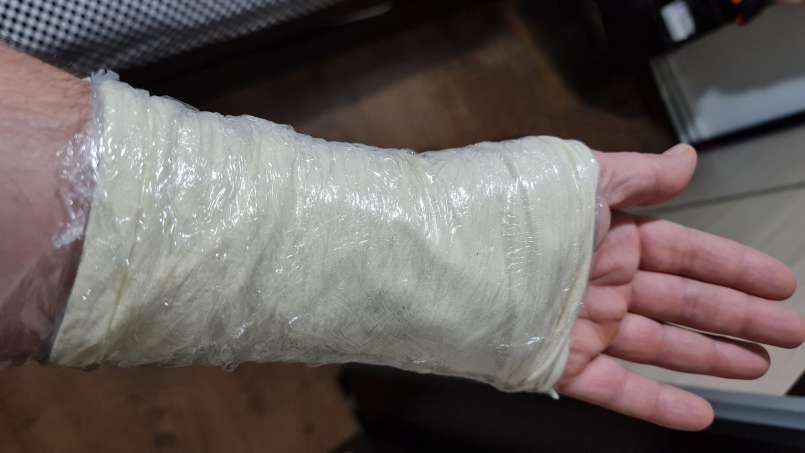 Poultice with cabbage leaves and borscht bran, photo 8